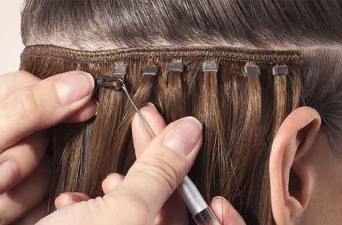 Best hair patch in Hyderabad